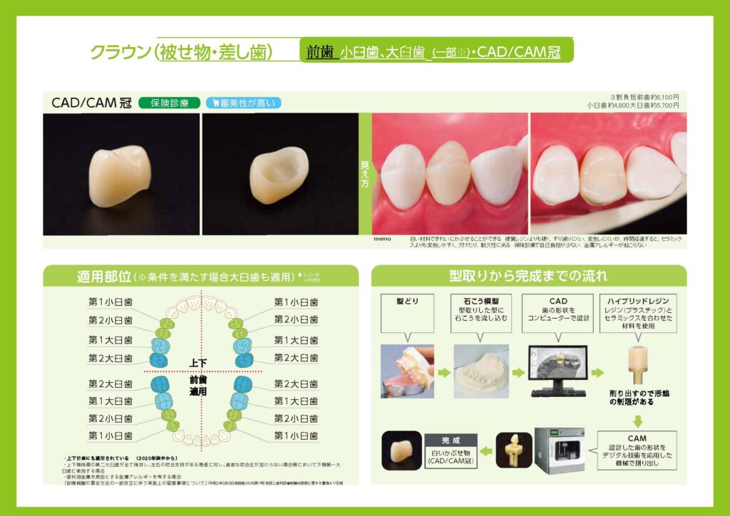 cadcam 冠 おすすめ しない